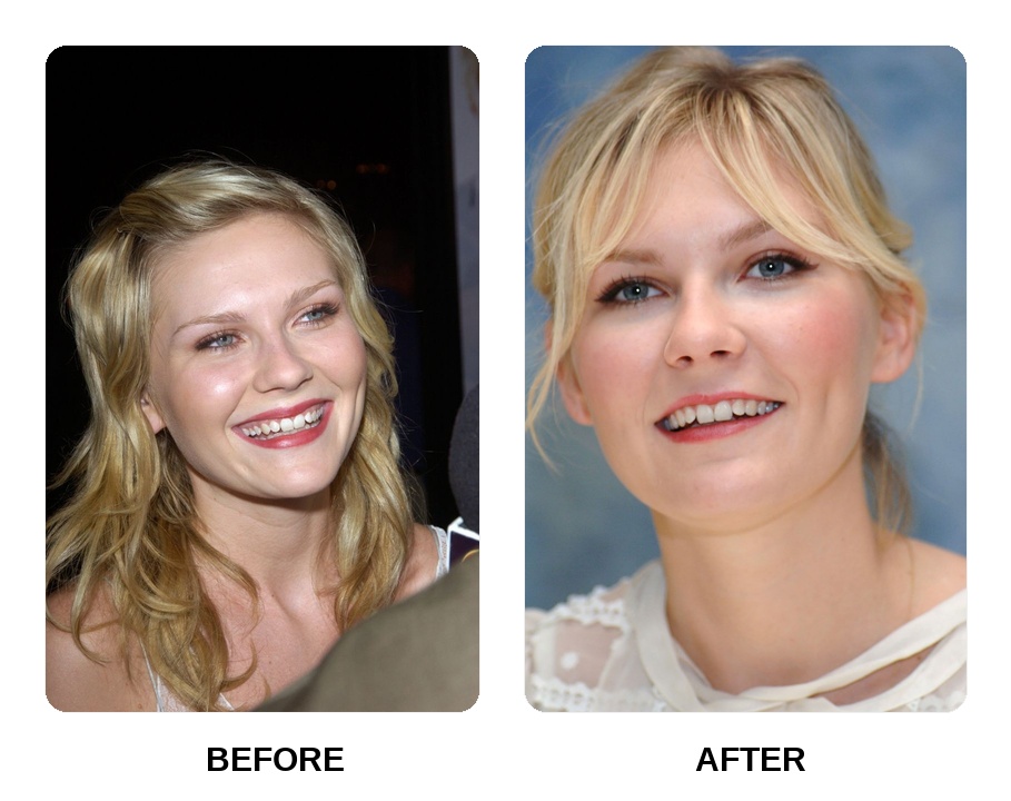 Kirsten Dunst smile collage